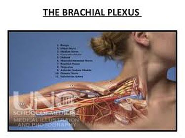 brachial plexus thoracic outlet syndrome neck pain Orlando