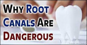 Root Canals And Essential Oils Orlando