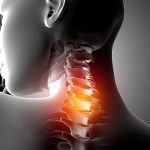 Herniated Disc Non-Surgical Treatment